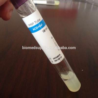 Customized high concentration platelet rich plasma prp tube